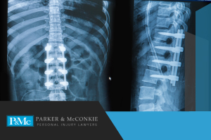 types-of-spinal-cord-injuries