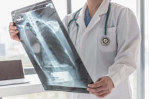 Why Choose Parker & McConkie Personal Injury Lawyers to Help Me After a Catastrophic Injury in Salt Lake City, UT?